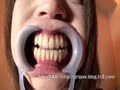 アダルト動画：【口・歯フェチ】あいりちゃんに開口器をつけてもらいました